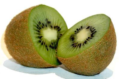 视频: 猕猴桃种植技术